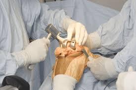 Specialist Orthopedic Surgery