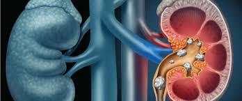 General Urology | Northern Ohio | Untapped Market Share and Collegial Group