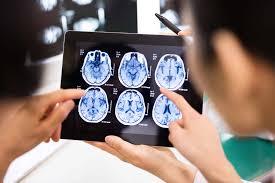 Renowned Neurologist Opportunity in Southern Illinois
