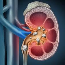 Pediatric Nephrology faculty opportunity, Riley Hospital for Children